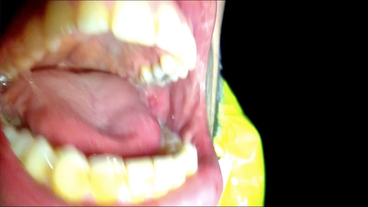 Amnesia Scanner - AS A.W.O.L