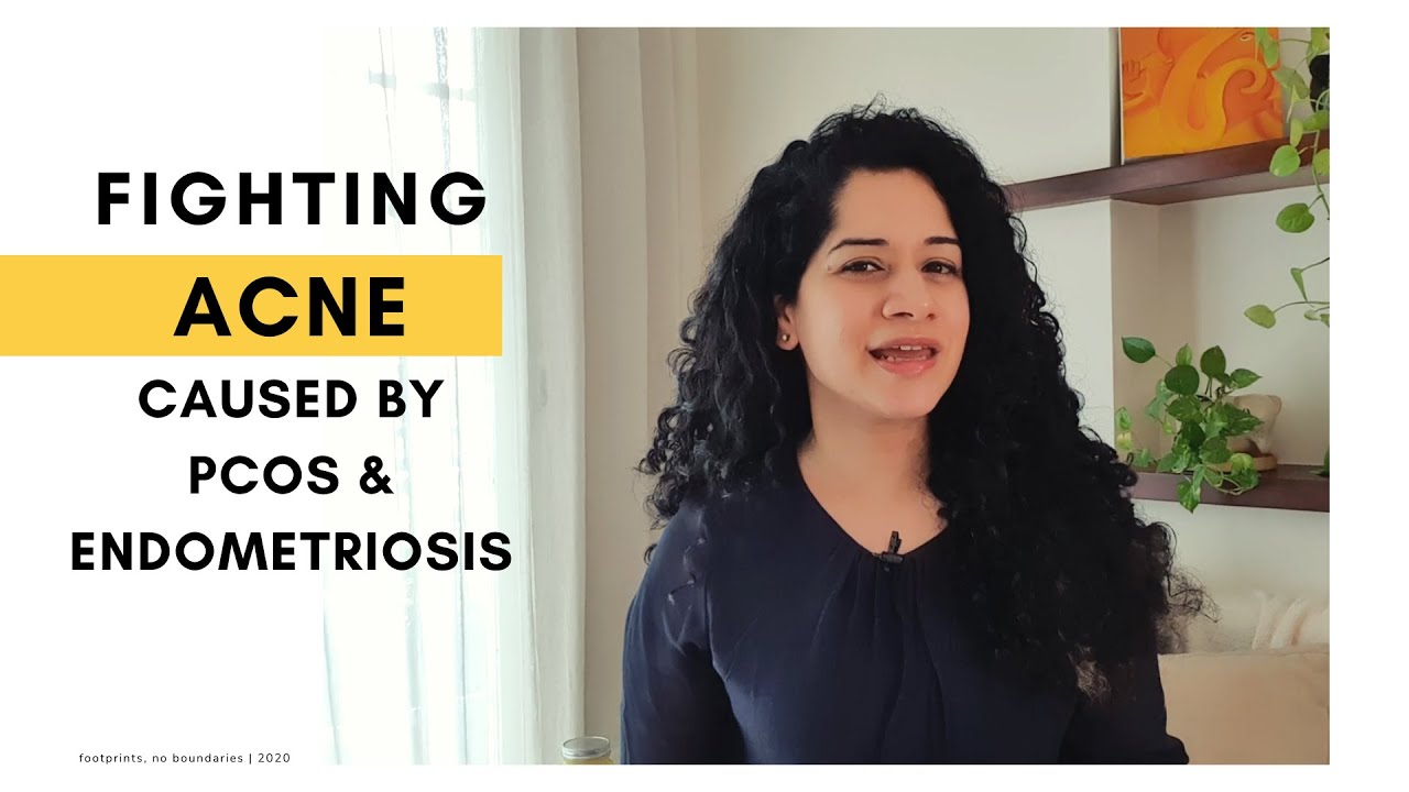 My Story: Fighting Acne Caused by PCOS, Endometriosis & Ehlers-Danlos Syndrome [CC]