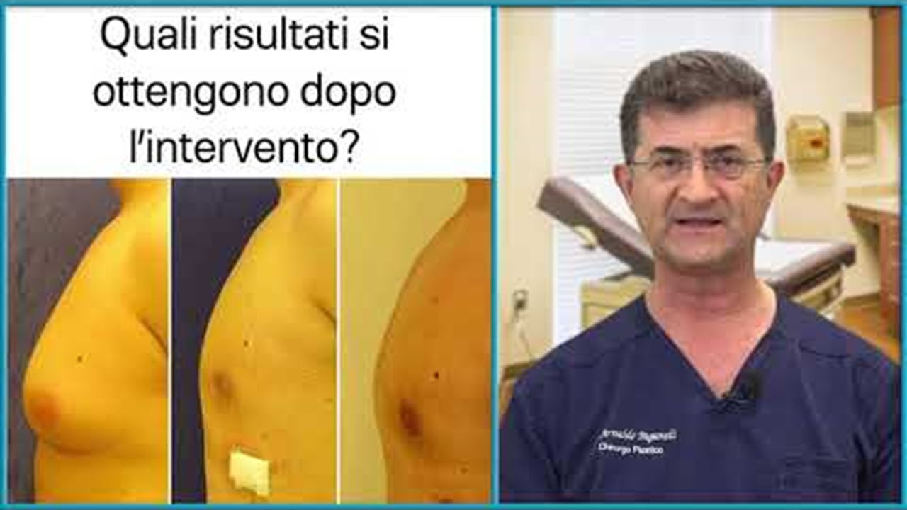 GINECOMASTIA: Quali risultati si ottengono dopo l'intervento