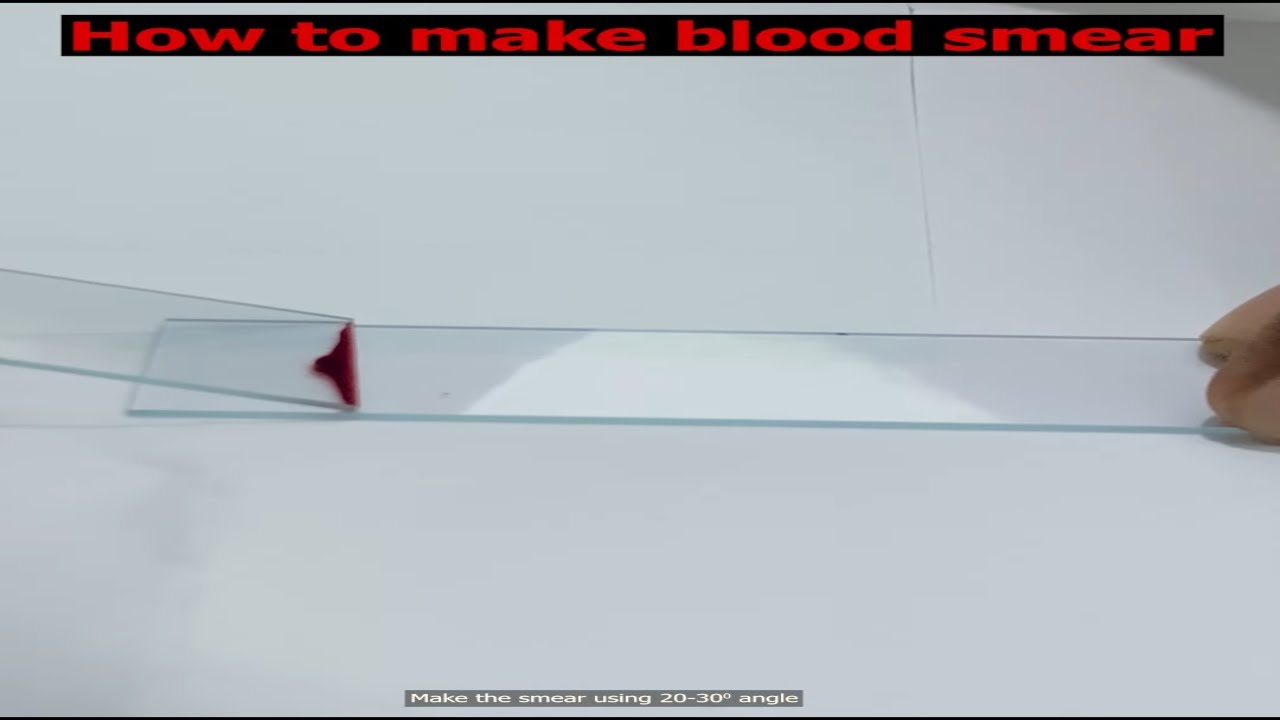 LEISHMAN STAINING | Blood Smear Staining Technique | Heamatology #labtest #labtesting #science