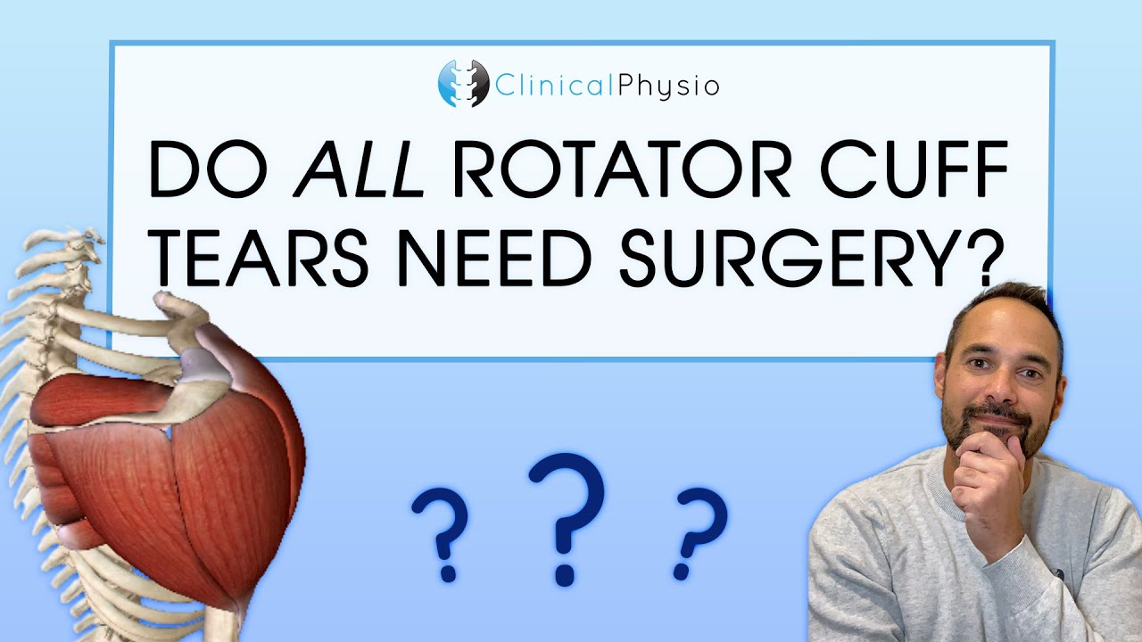 Why Rotator Cuff Tears Don't Always Need Surgery | Expert Physio Review