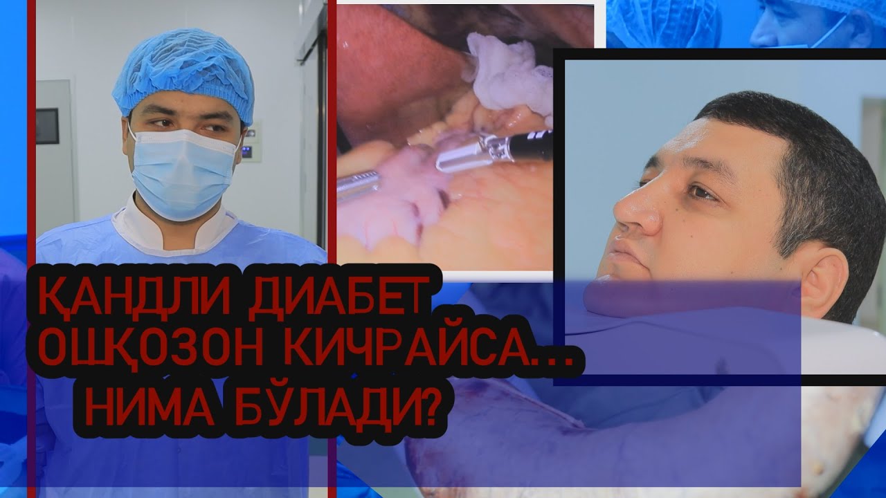 САХАР ДАВОСИ, ОШҚОЗОН КИЧРАЙТИРИШ ОЧИҚ-ОЙДИН АЙТИЛДИ 95-977-19-27