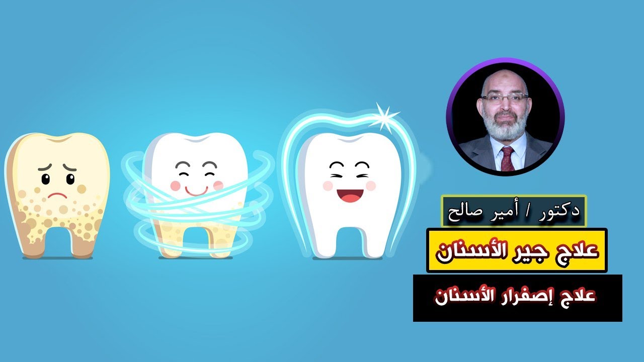 علاج جير الأسنان وصفارها برنامج الطب الأمن دكتور أمير صالح