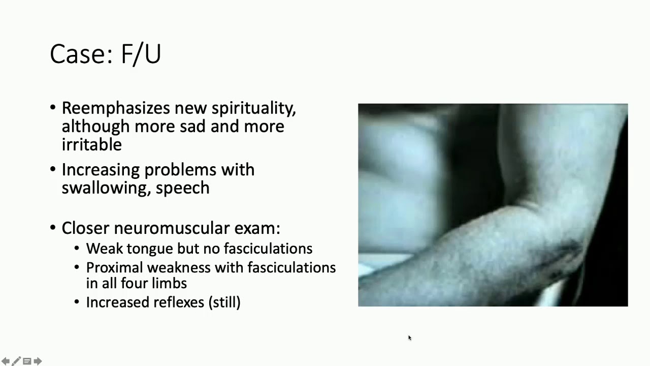 Clinical Issues Breakout Session: Managing ALS/FTD & Movement Disorders
