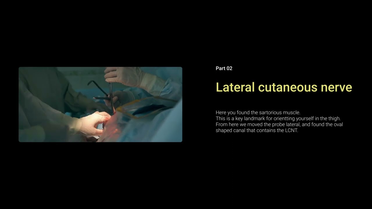 Femoral nerve and lateral cutaneous nerve of the thigh (LCNT) block by an anaesthetic registrar