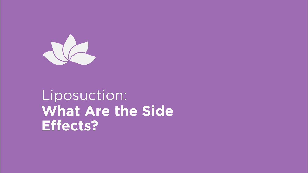 What Are the Side Effects of Liposuction? | Plastic Surgeon Explains