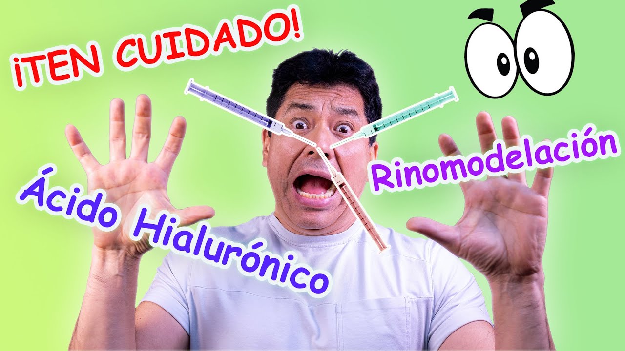 Acido Hialurónico en Rinomodelación