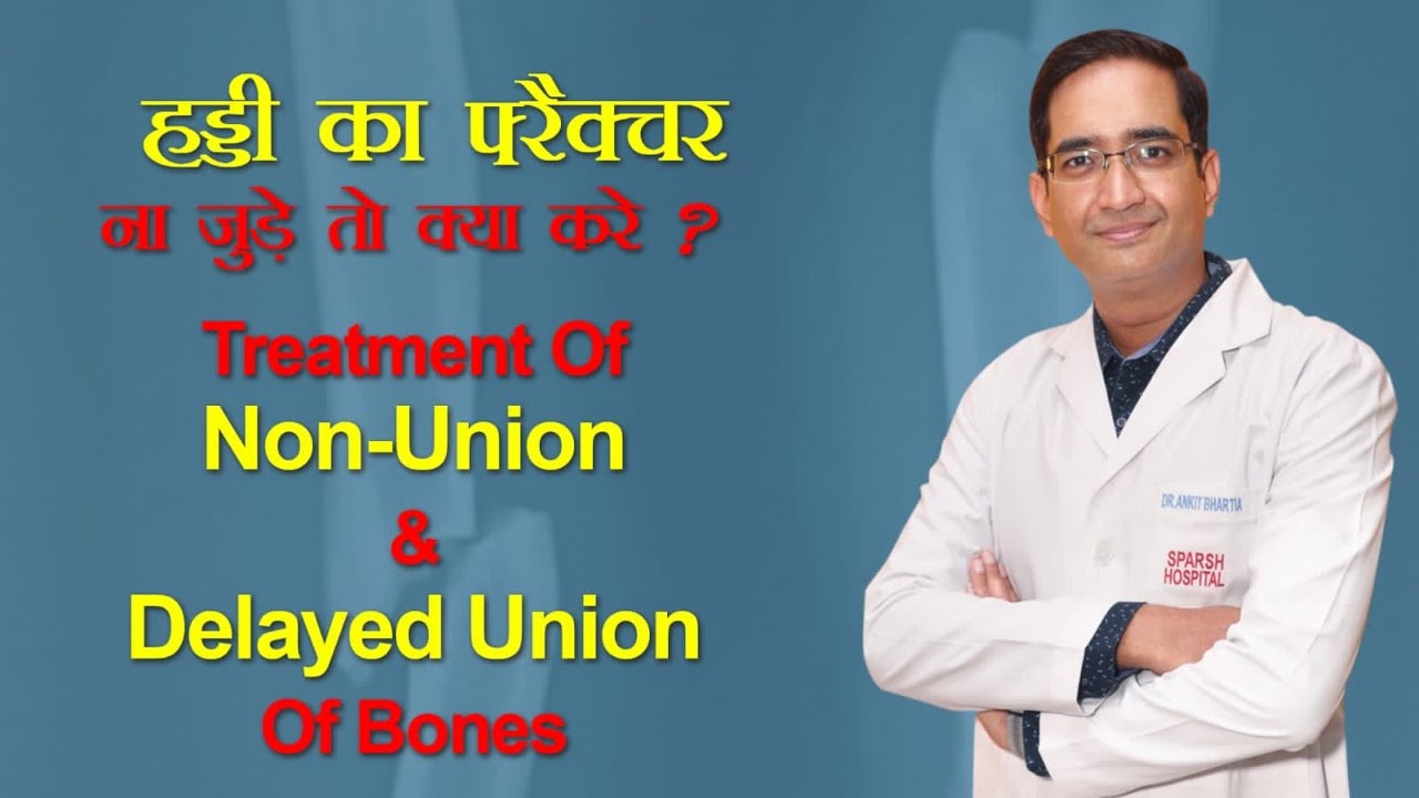 हड्डी का फ़्रैक्चर ना जुड़े तो क्या करे ? Treatment of non-union and delayed union of bones.