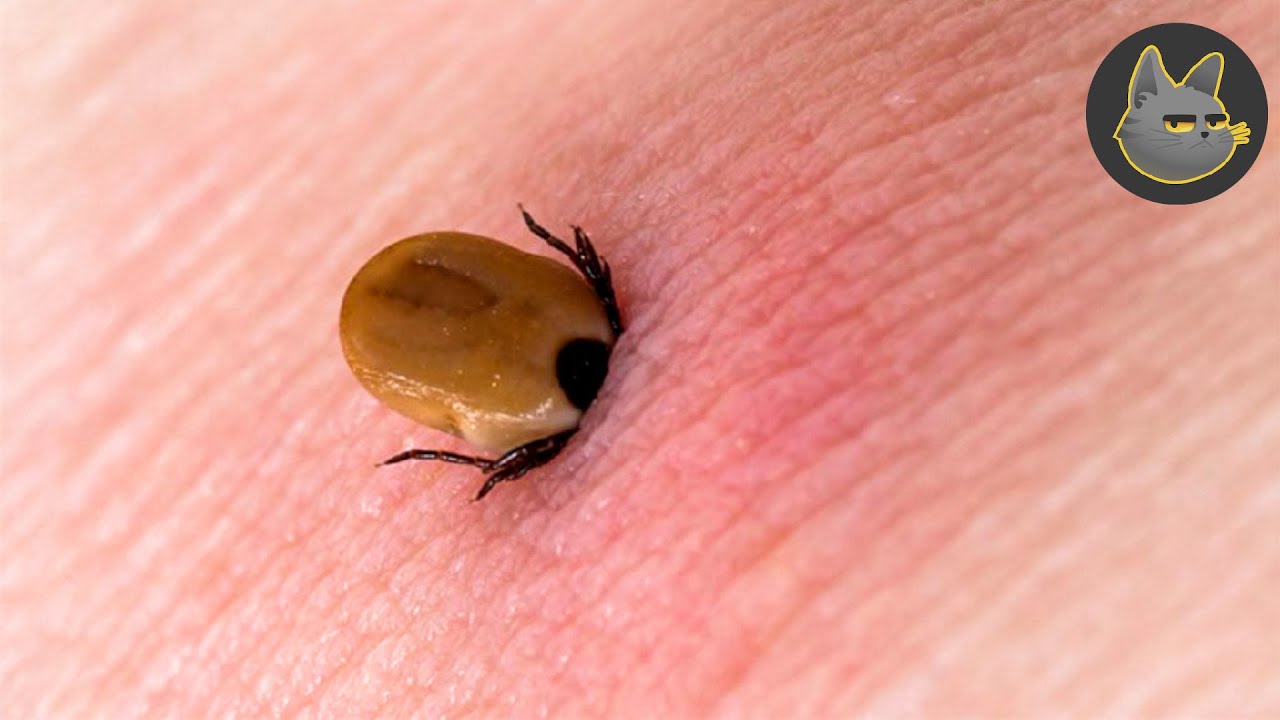 10 Peores Picaduras Que Un Humano Puede Experimentar