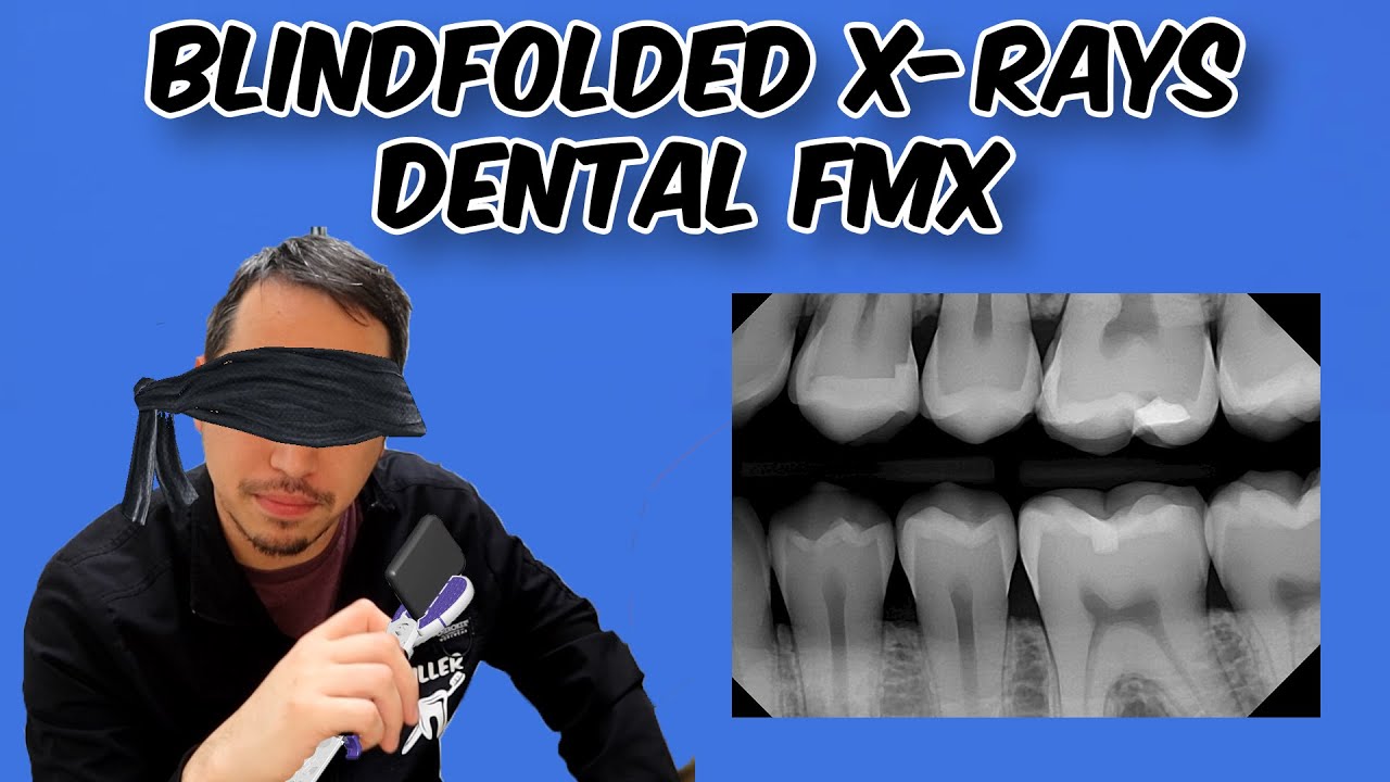 Blindfolded Dental X-Rays - Dental Challenge
