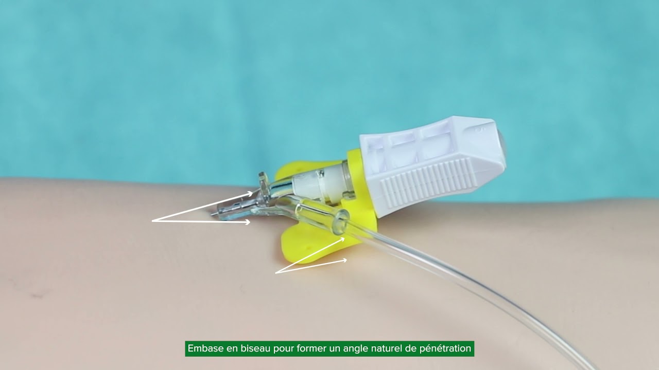 Pose d'un cathéter sécurisé sous-cutanée Nouvo Safety® - Asept InMed