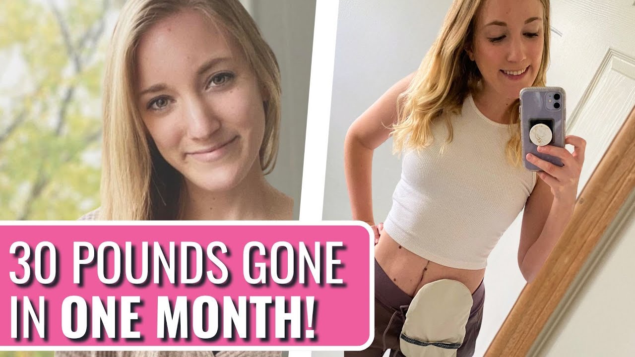 For Months I Thought It Was A Stomach Bug! - Dana | Crohn's Disease | The Patient Story