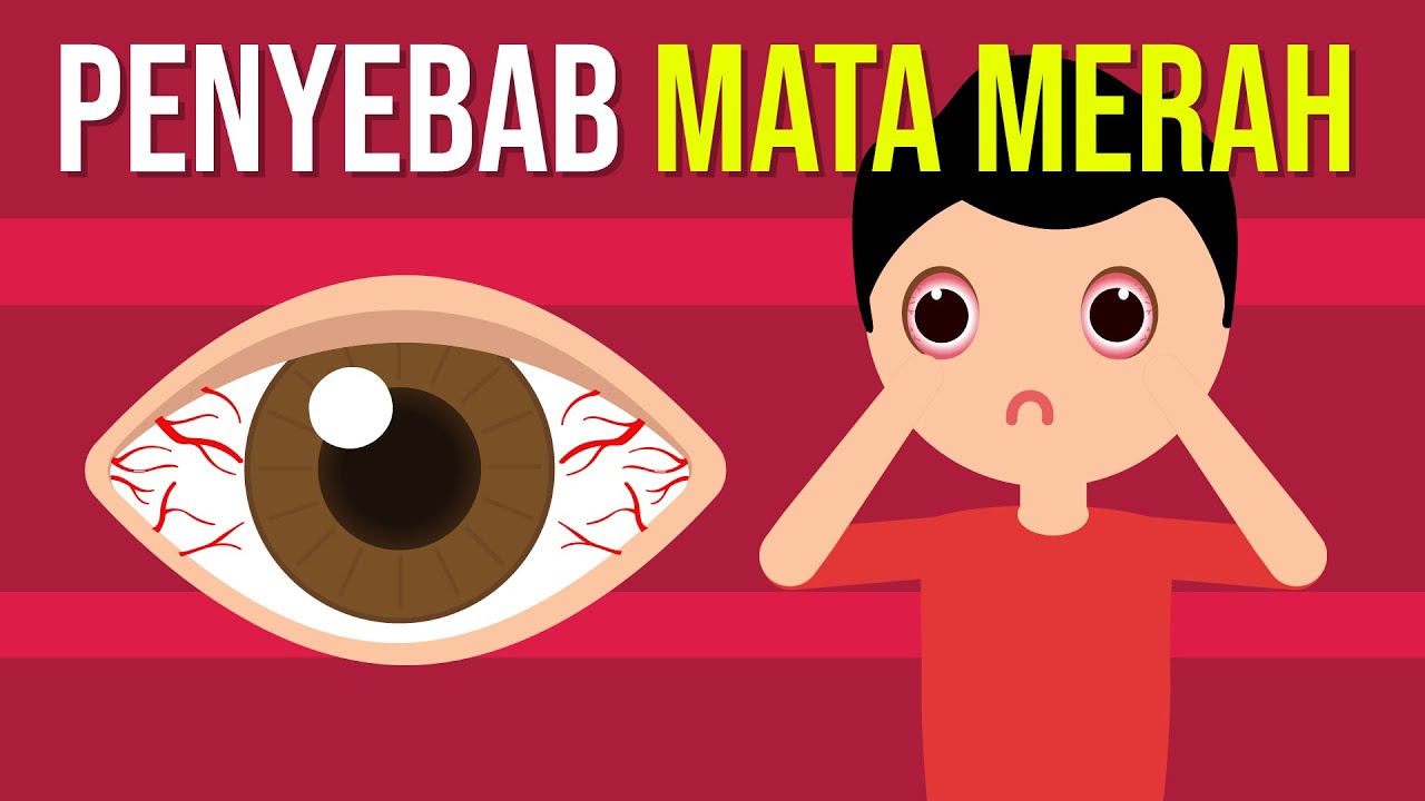 Apa yang Menyebabkan Mata Merah?