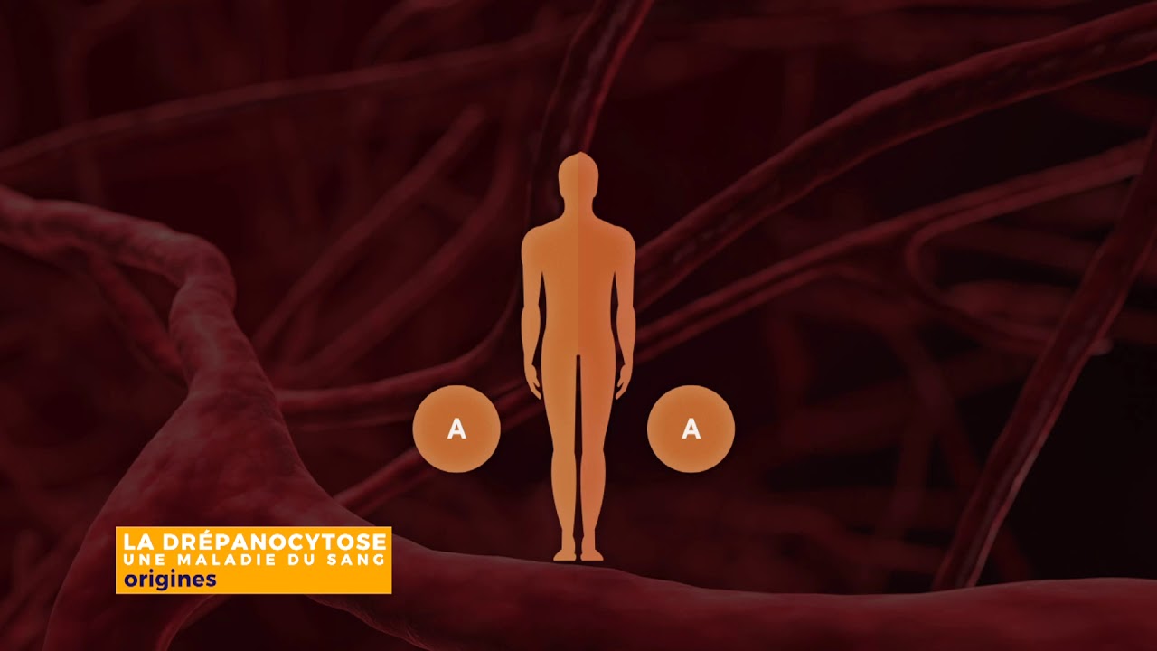 #1 La drépanocytose qu’est-ce que c’est ?