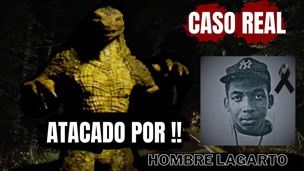 El Adolescente que fue Atacador por el Hombre Lagarto (Caso Real Lizardman 1988)