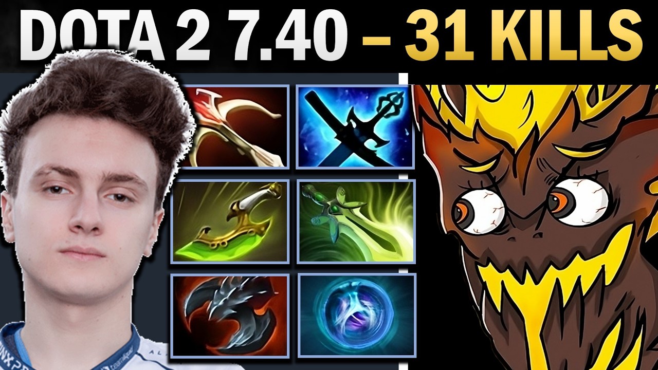 Shadow Fiend, профессиональный керри с 31 убийством и Linken'ом — геймплей Dota.