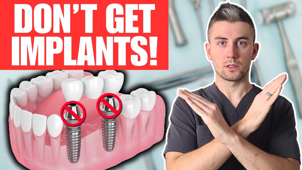 Don’t Get Dental Implants Watch This First