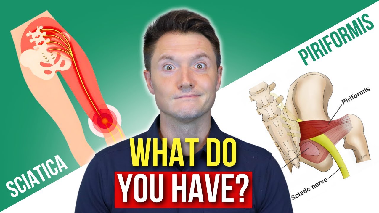 Figure Out If You Have Sciatica or Piriformis Syndrome!