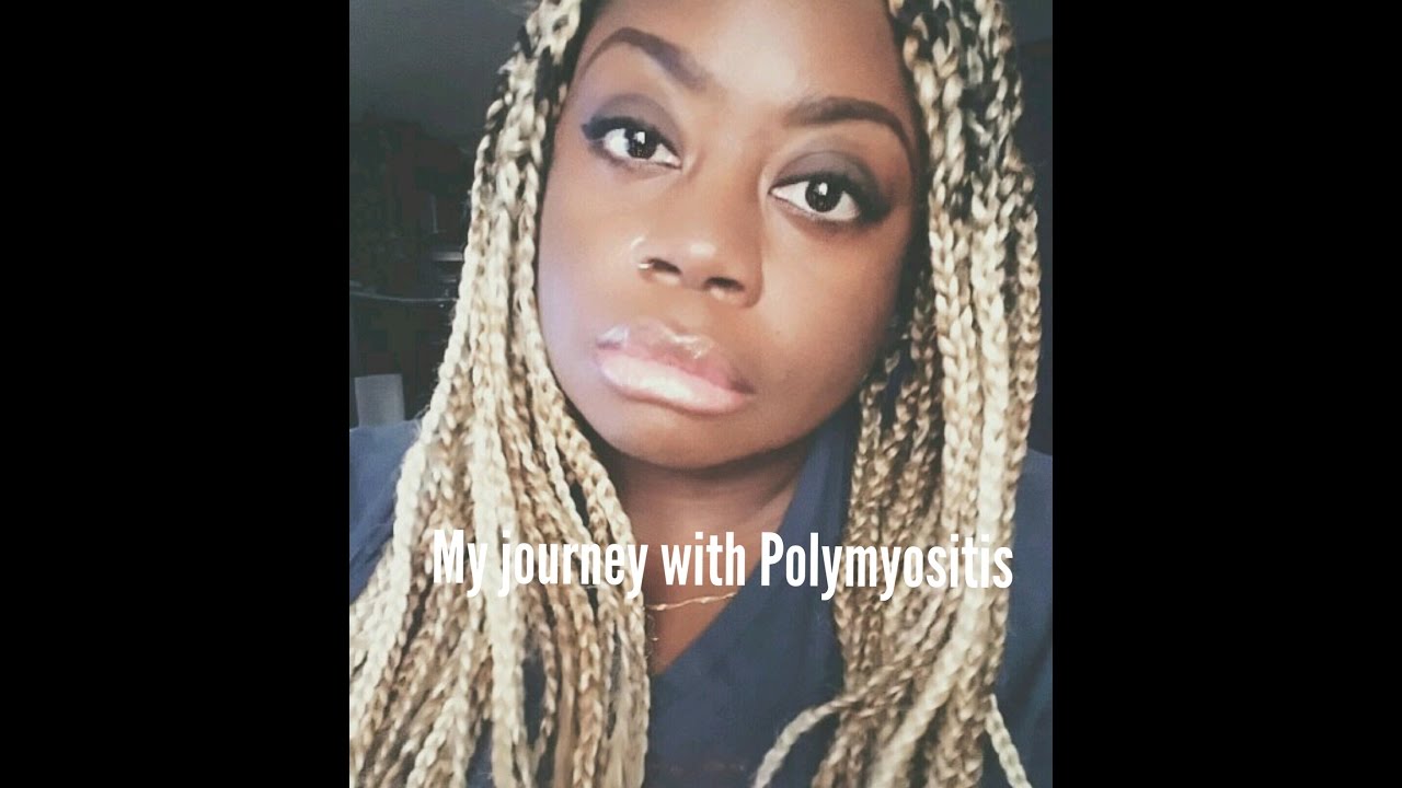My journey with polymyositis