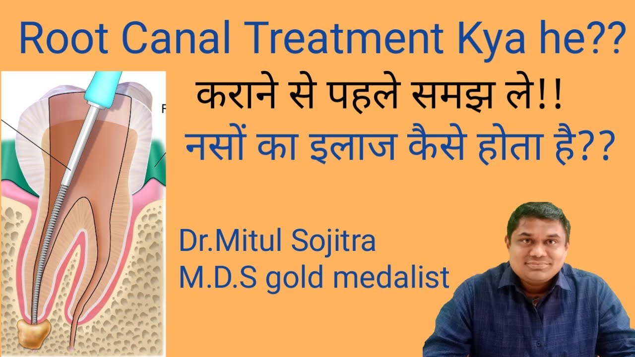 Rct in hindi l what is root canal treatment ? (Full Procedure) Solution for dental pain??