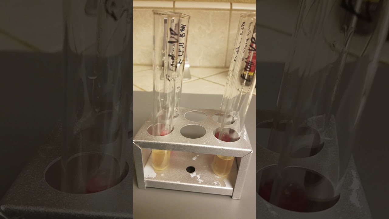 Biochemical testing for microbial identification part 2