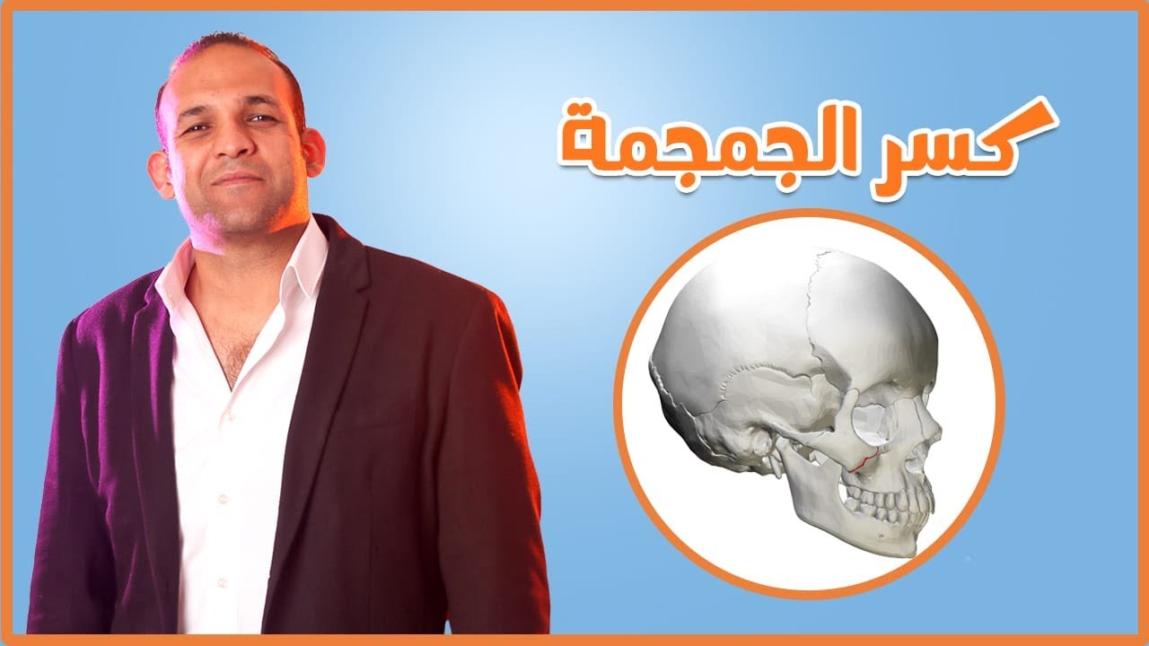 كسر الجمجمة - دكتور محمد سمير الملا