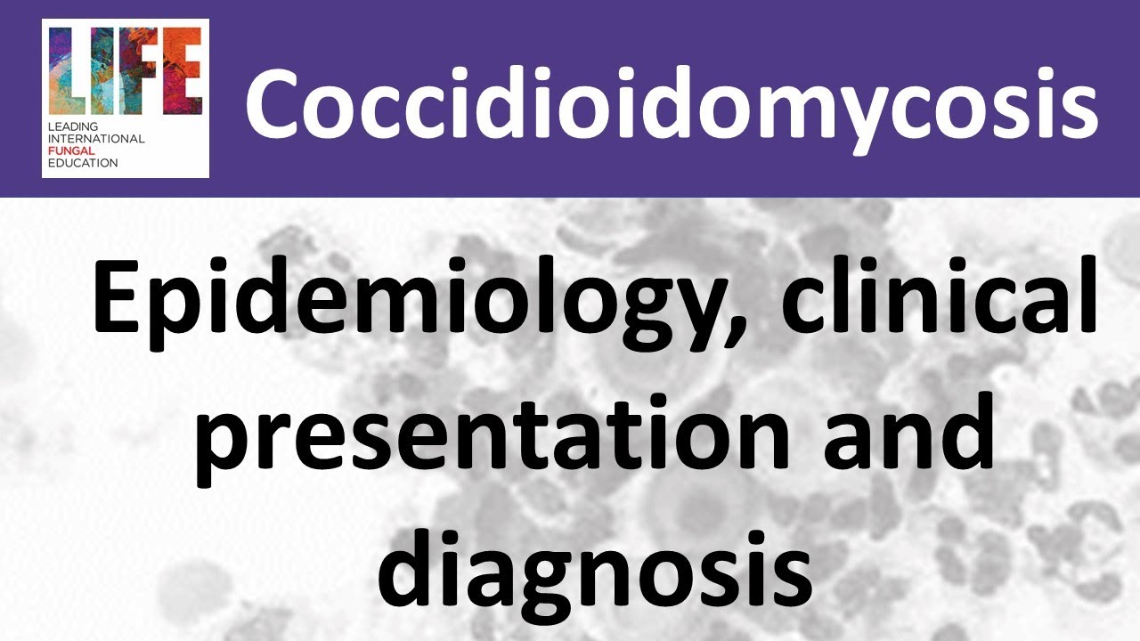 Coccidioidomycosis – epidemiology, clinical presentation and diagnosis