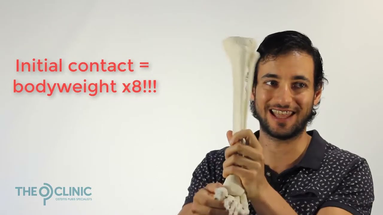 OP mechanics: over pronation/supination, do i need orthotics?