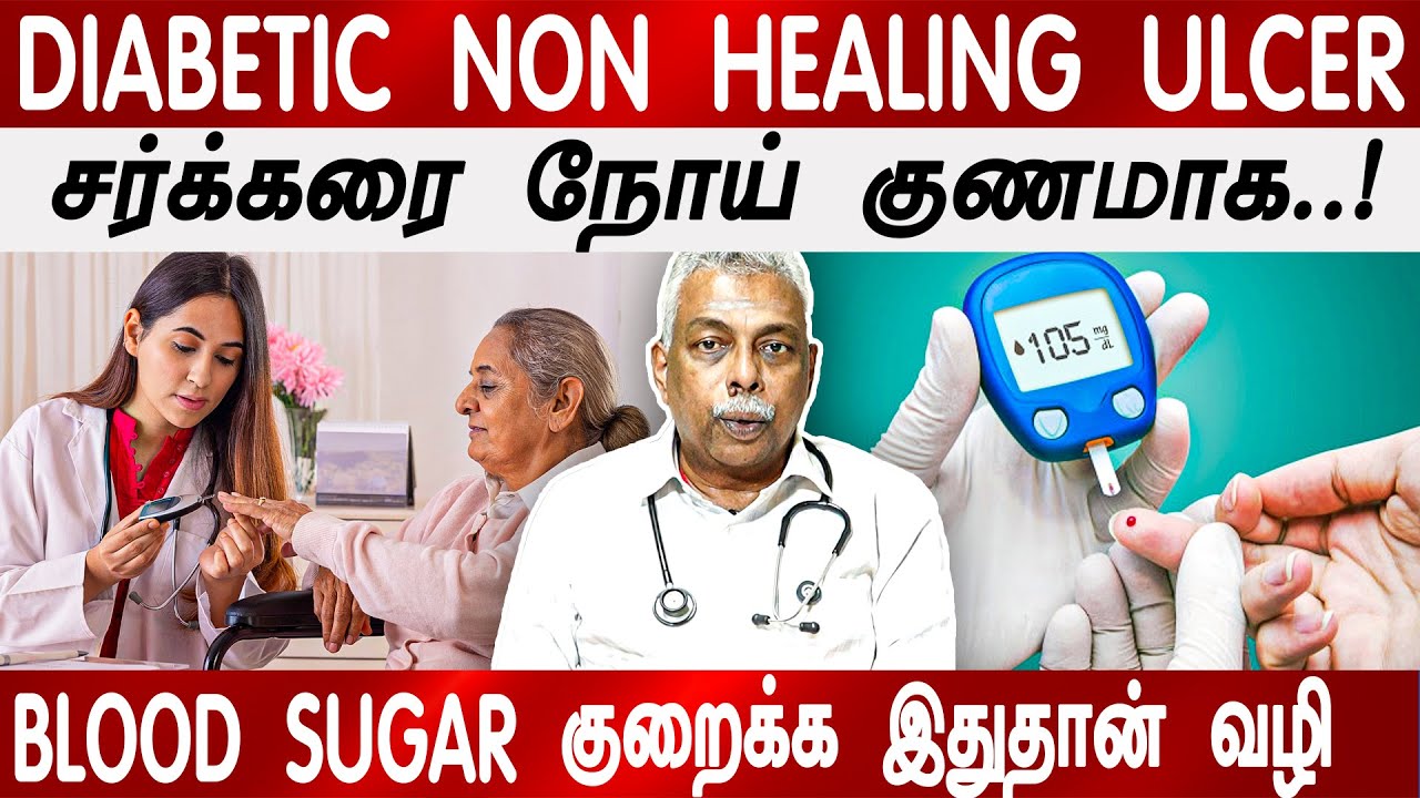 DIABETIC NON HEALING ULCER - சர்க்கரை அளவை குறைக்க இதுதான் வழி!
