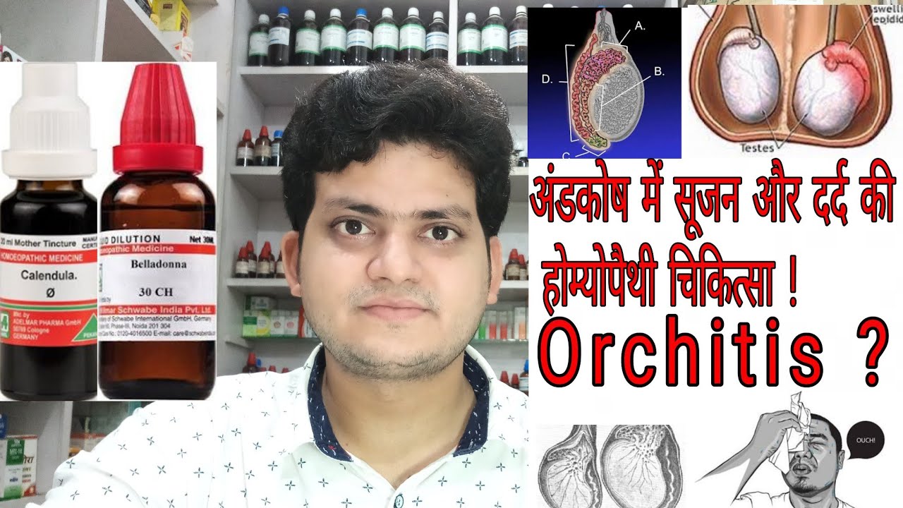 Orchitis ! Homeopathic medicine for Orchitis ? Explain !