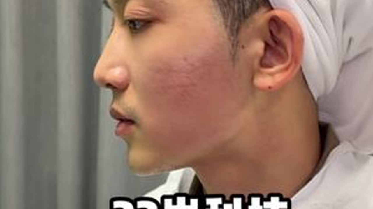 33岁和18岁怎么选?今天vlog。#可变焦超声刀 #紧致 33岁和18岁怎么选?今天vlog。#可变焦超声刀 #紧致 #少年感