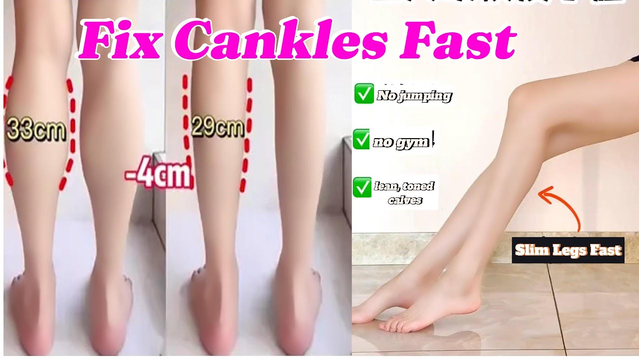 Fix Cankles Fast at Home | No Jumping, No Gym, Just Toned Calves!
