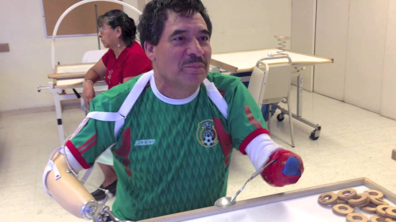 Adaptación alimentación para amputado de miembro superior