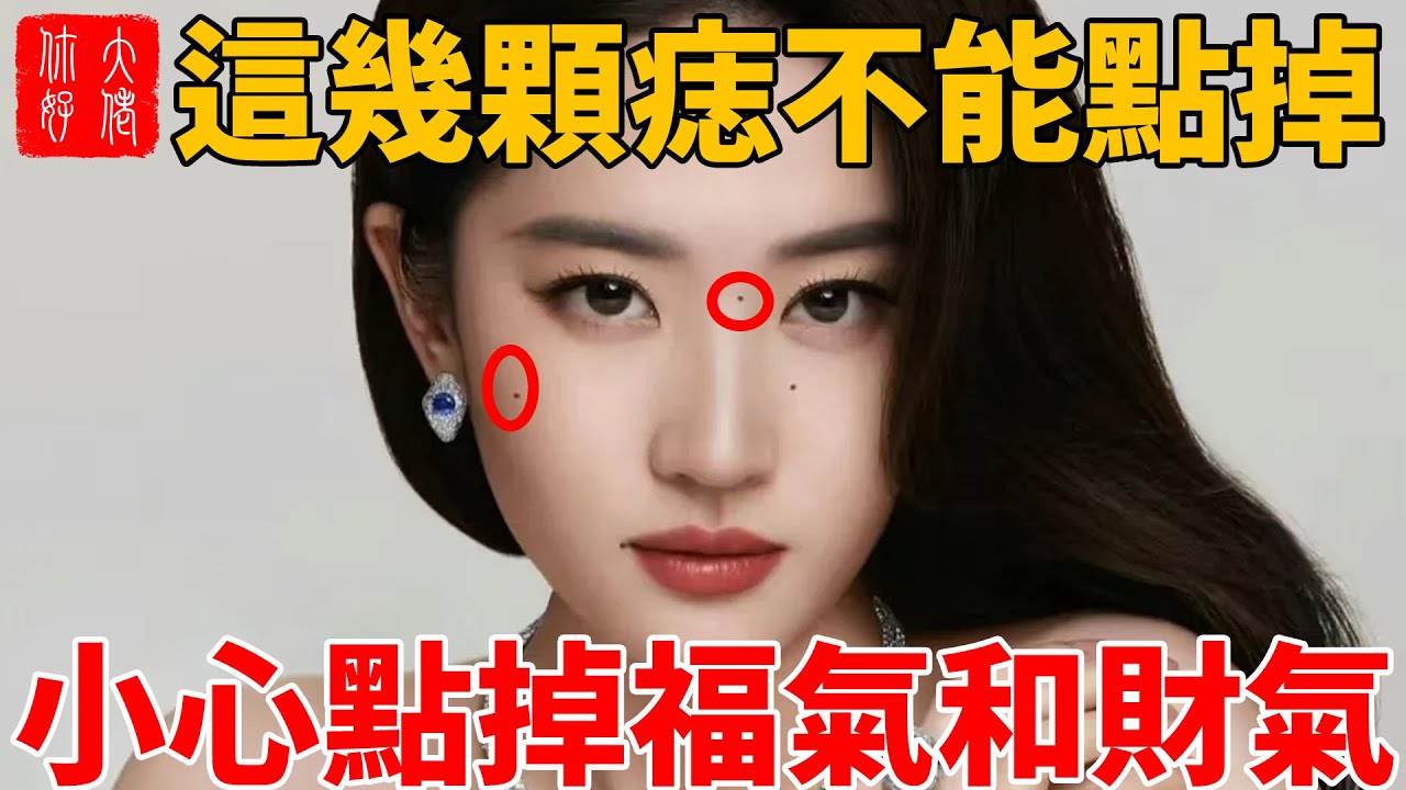 痣相凶痣：面部大富大贵的4种痣不要去掉，小心钱财流失
