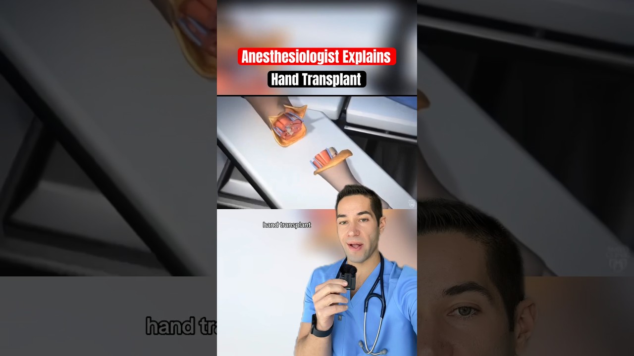 This is how hand transplants work