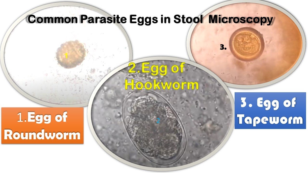 Roundworm, Tapeworm and Hookworm eggs in Stool Microscopy
