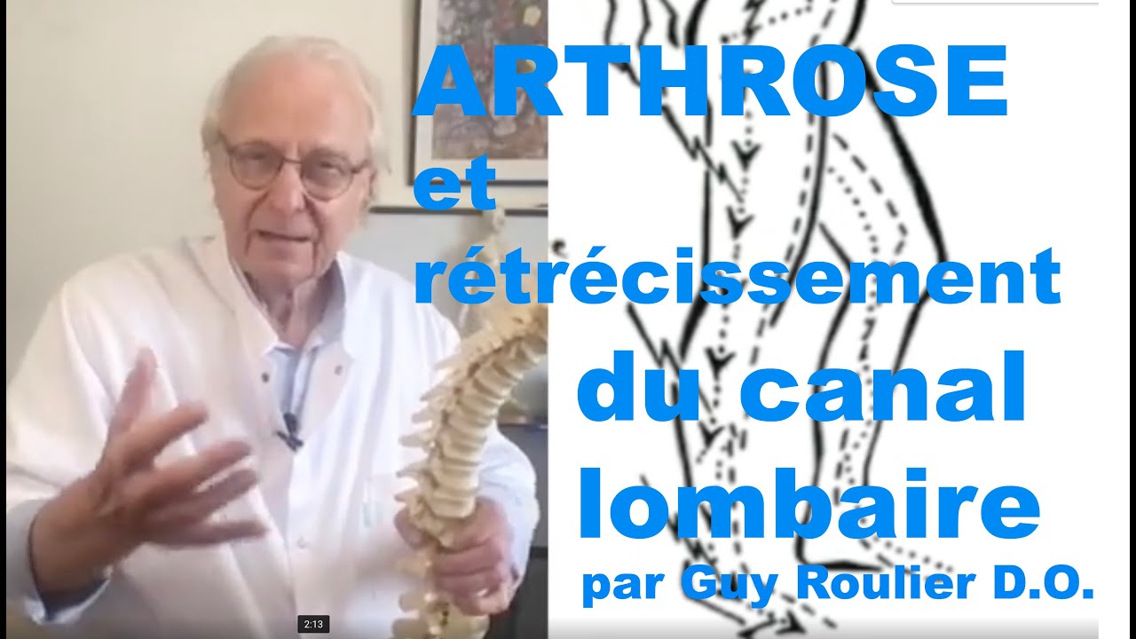 Vidéo Arthrose et rétrécissement du canal lombaire. Une solution naturelle à essayer par Guy Roulier