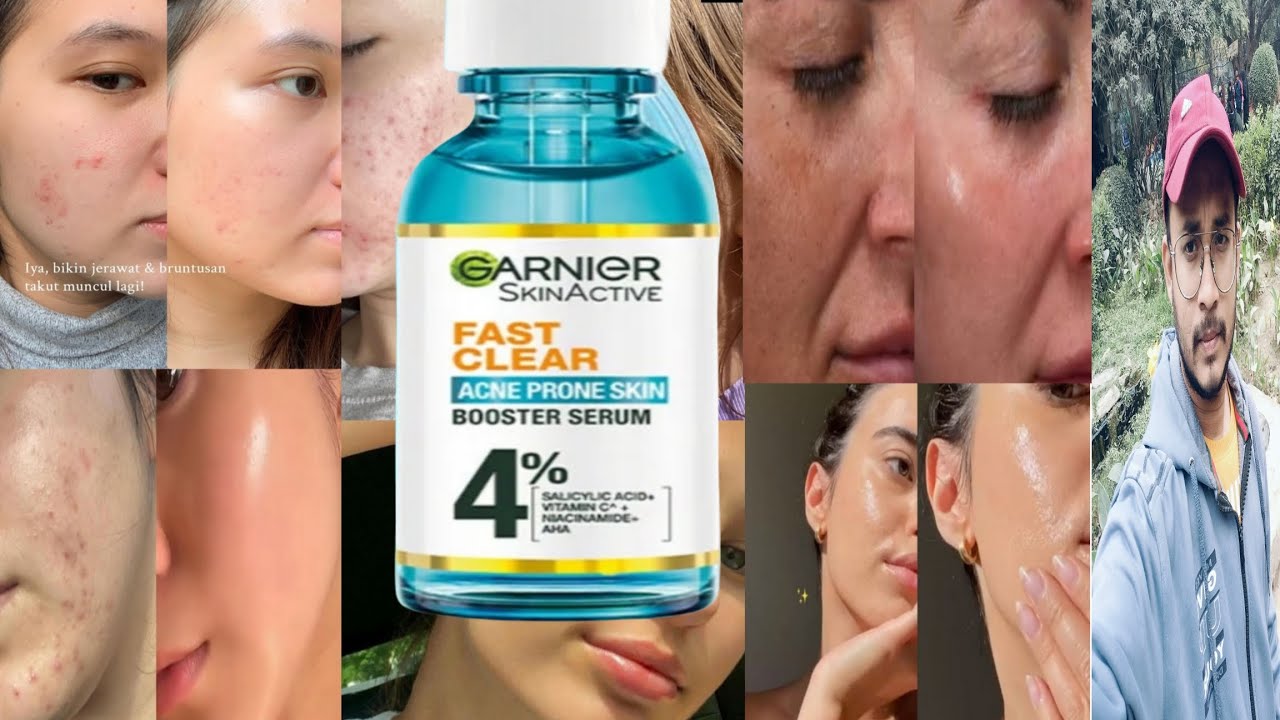 Garnier Fast Clear Booster Serum | Honest Review