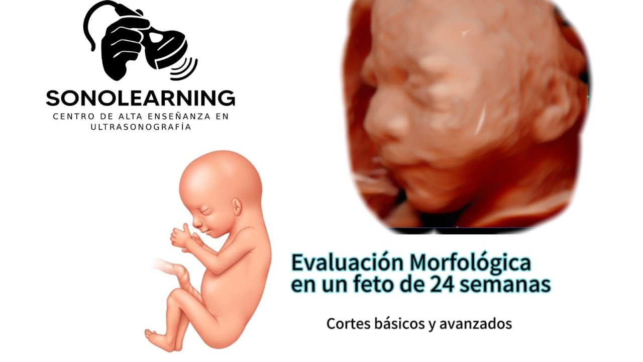 EVALUACION MORFOLOGICA EN UN FETO DE 24 SEMANAS, CORTES BASICOS Y AVANZADOS