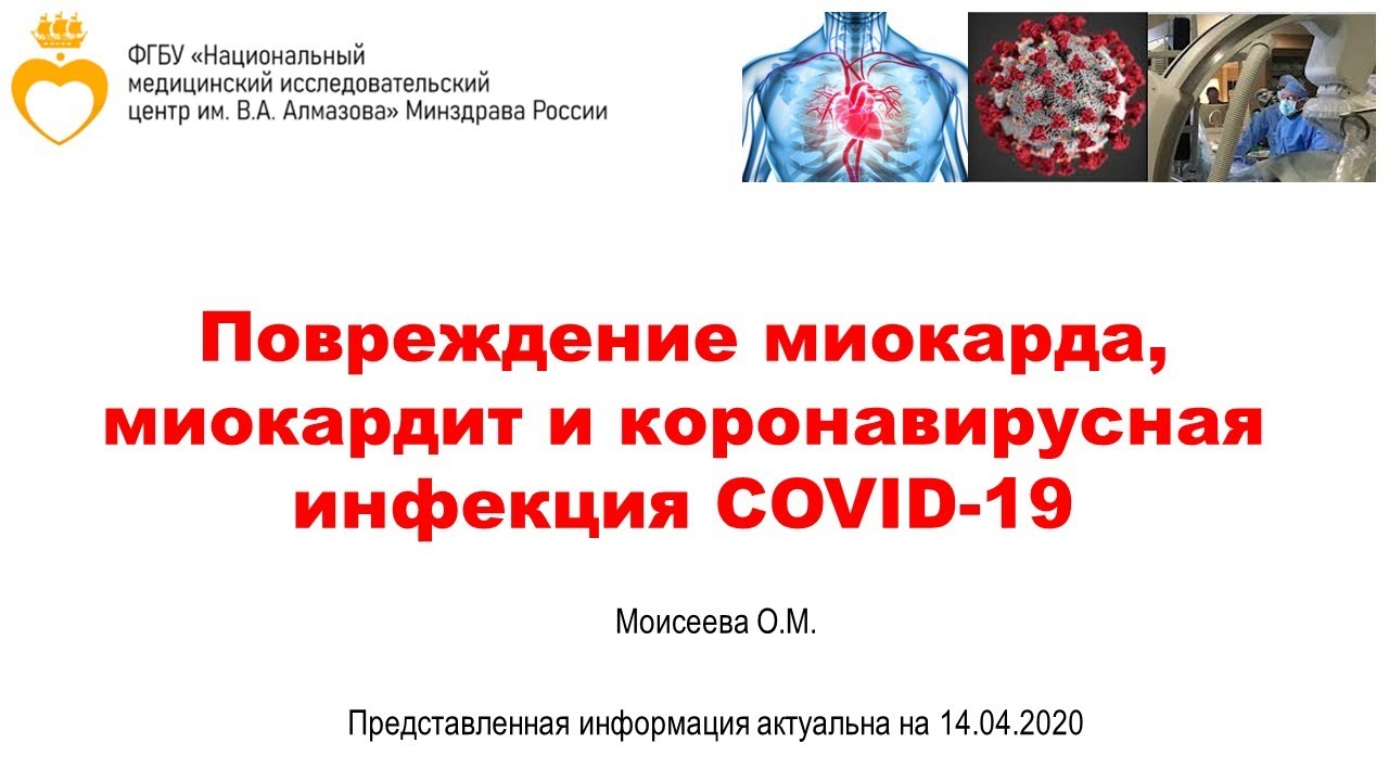 Миокардиальное повреждение, миокардит и COVID-19