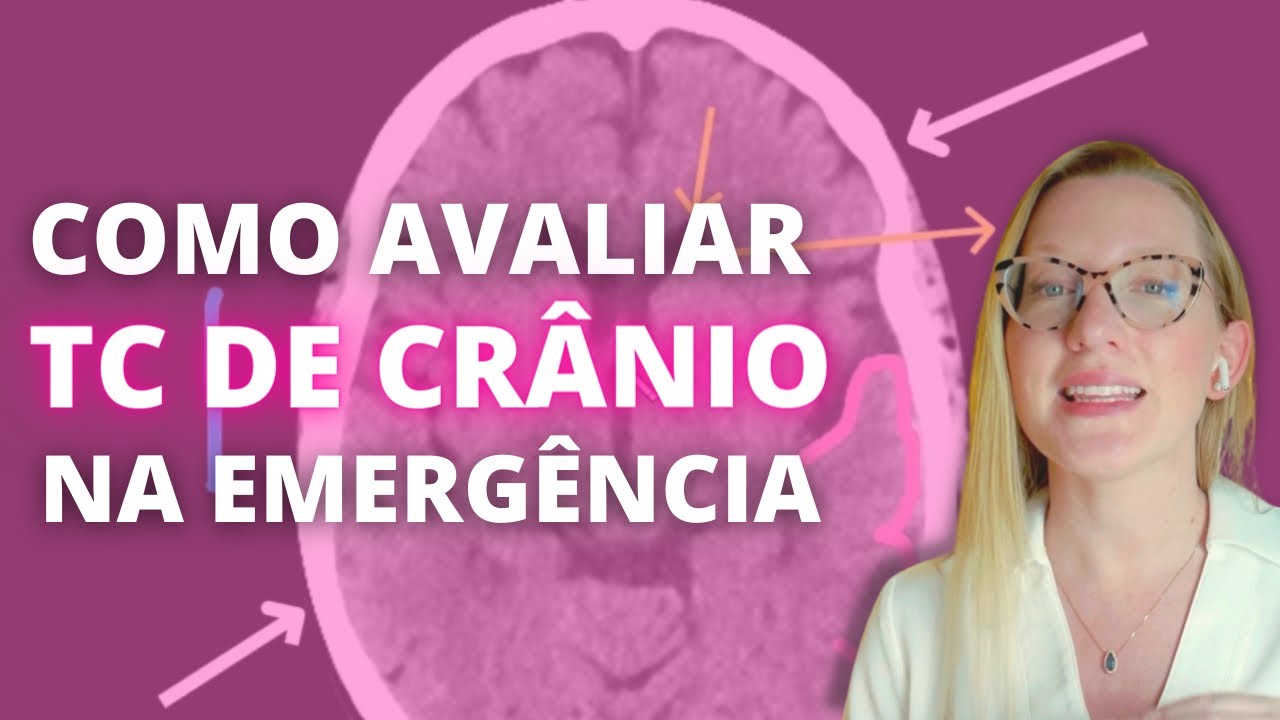 Como avaliar TC crânio na emergência: passo a passo