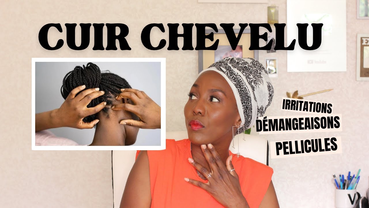 PELLICULES? DÉMANGEAISONS? IRRITATIONS??!!! HELP ‼️COMMENT CALMER LE CUIR CHEVELU !