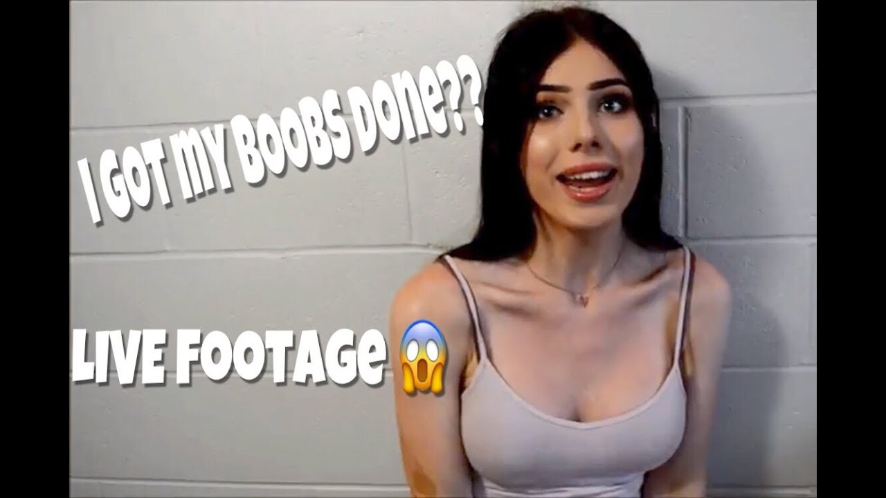 My Breast Augmentation Story | Transgender | Victoria Rose