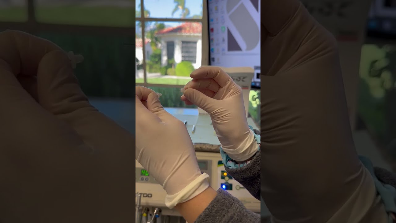 Unboxing Video for X-Tip Intraosseous Anesthesia