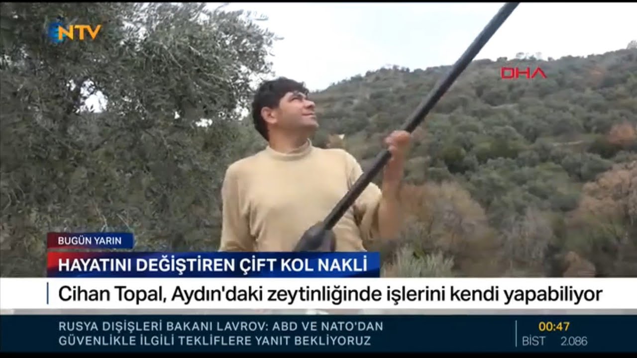 12 yıl önce çift kol nakli yapılan çiftçi, tıp tarihine geçti