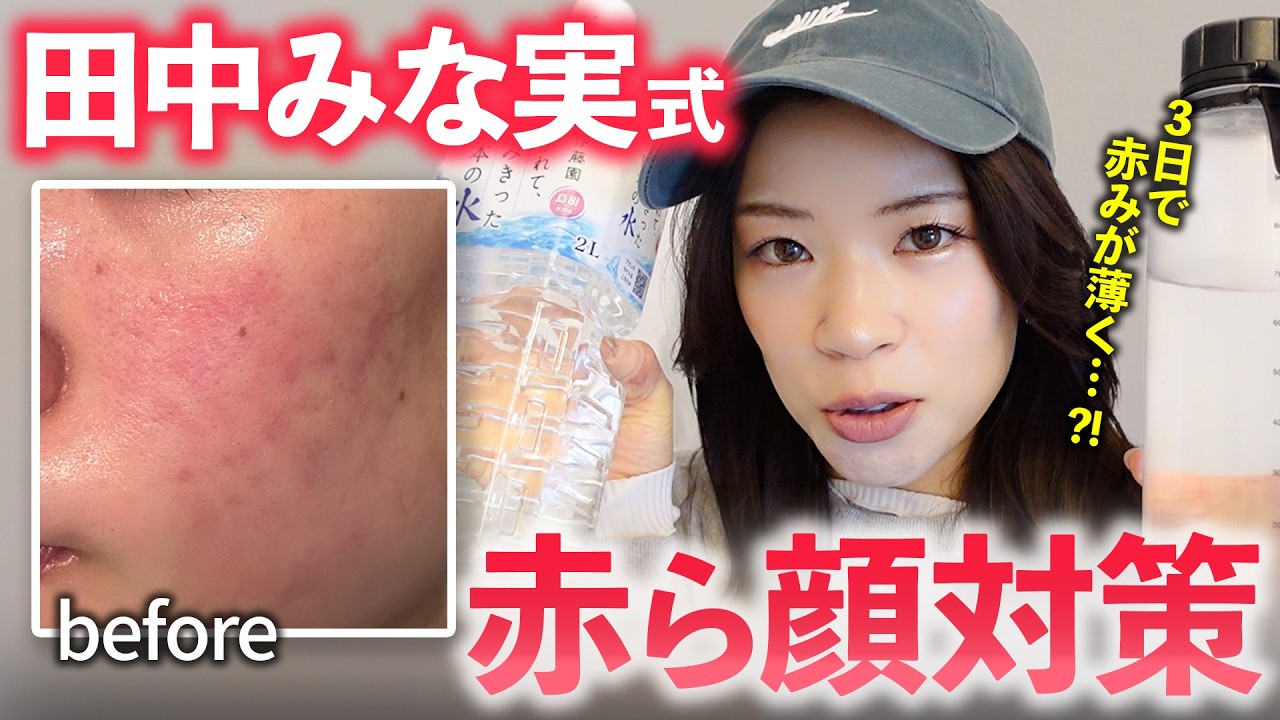 【赤ら顔】田中みな実の”保湿ケア”を3日試したら…赤み激変!【肌の赤み敏感肌に悩む人必見】