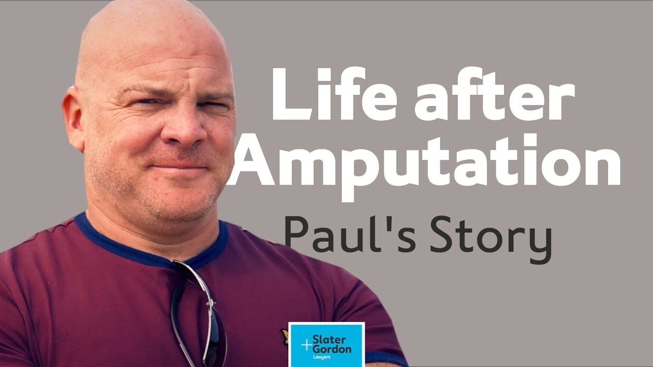 Paul's Story: Life After Amputation