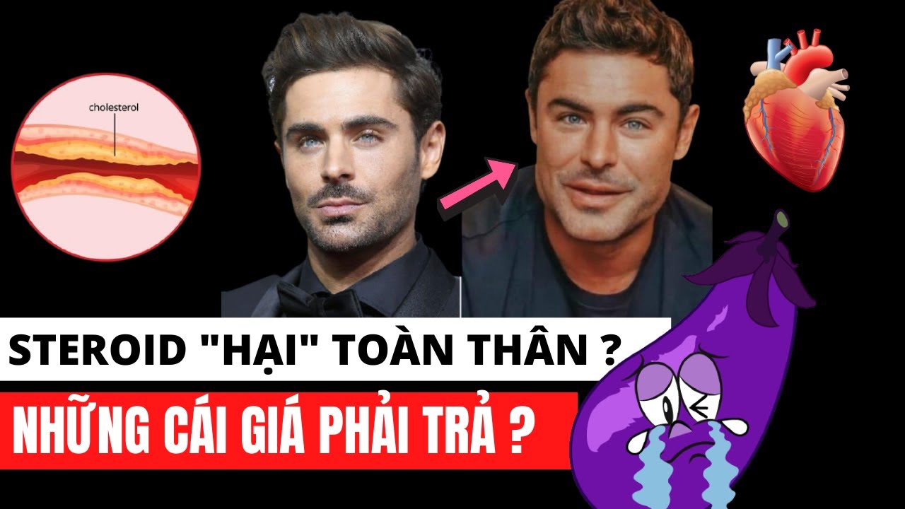 Ảnh hưởng của Steroid với cơ thể ? Những cái giá phải trả !
