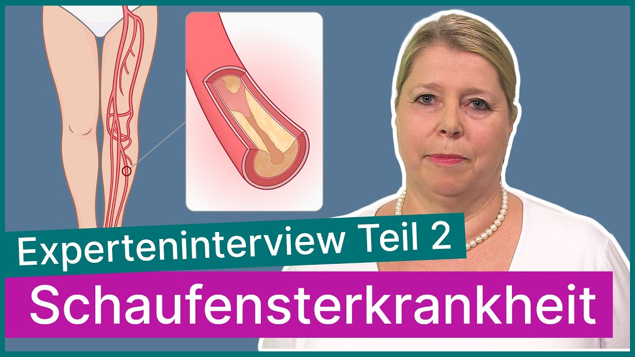 Schaufensterkrankheit (Claudicatio intermittens) - Teil 2 von 2 | Asklepios