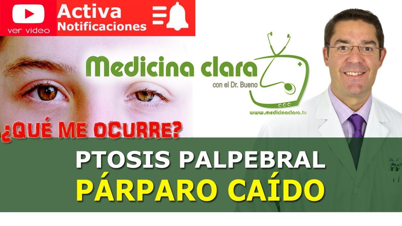 Ptosis palpebral o Párpado caído | Medicina Clara